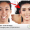 Plastic Surgery – Boon or Bane